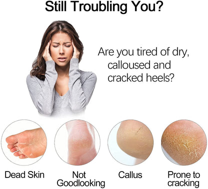 Electric Foot Grinder Vacuum Foot Grinding Machine Exfoliating Dead Skin Callus Remover Foot Care